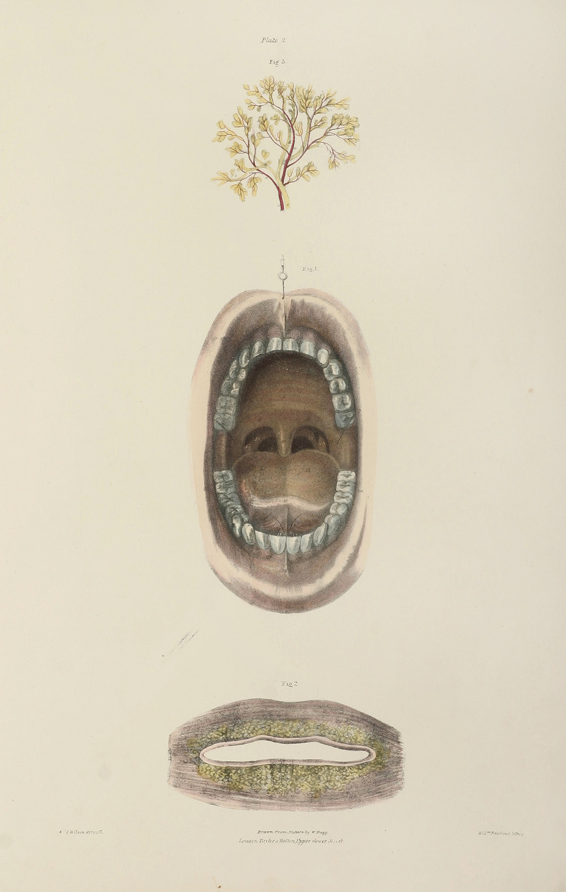 Anatomy of the Mouth, the Mucous Glands, and the development of the Parotid Gland. - Antique Print from 1838