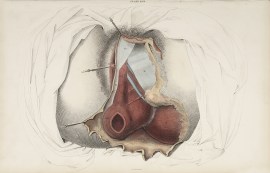 [ORGANS] Dissection of the perineum, female