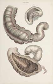 [ORGANS] Ileum, colon and appendix