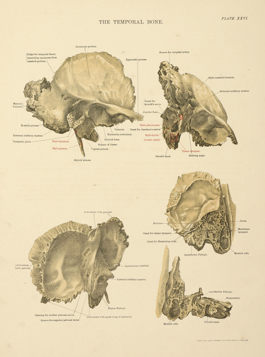 The Temporal Bone - Antique Print from 1885