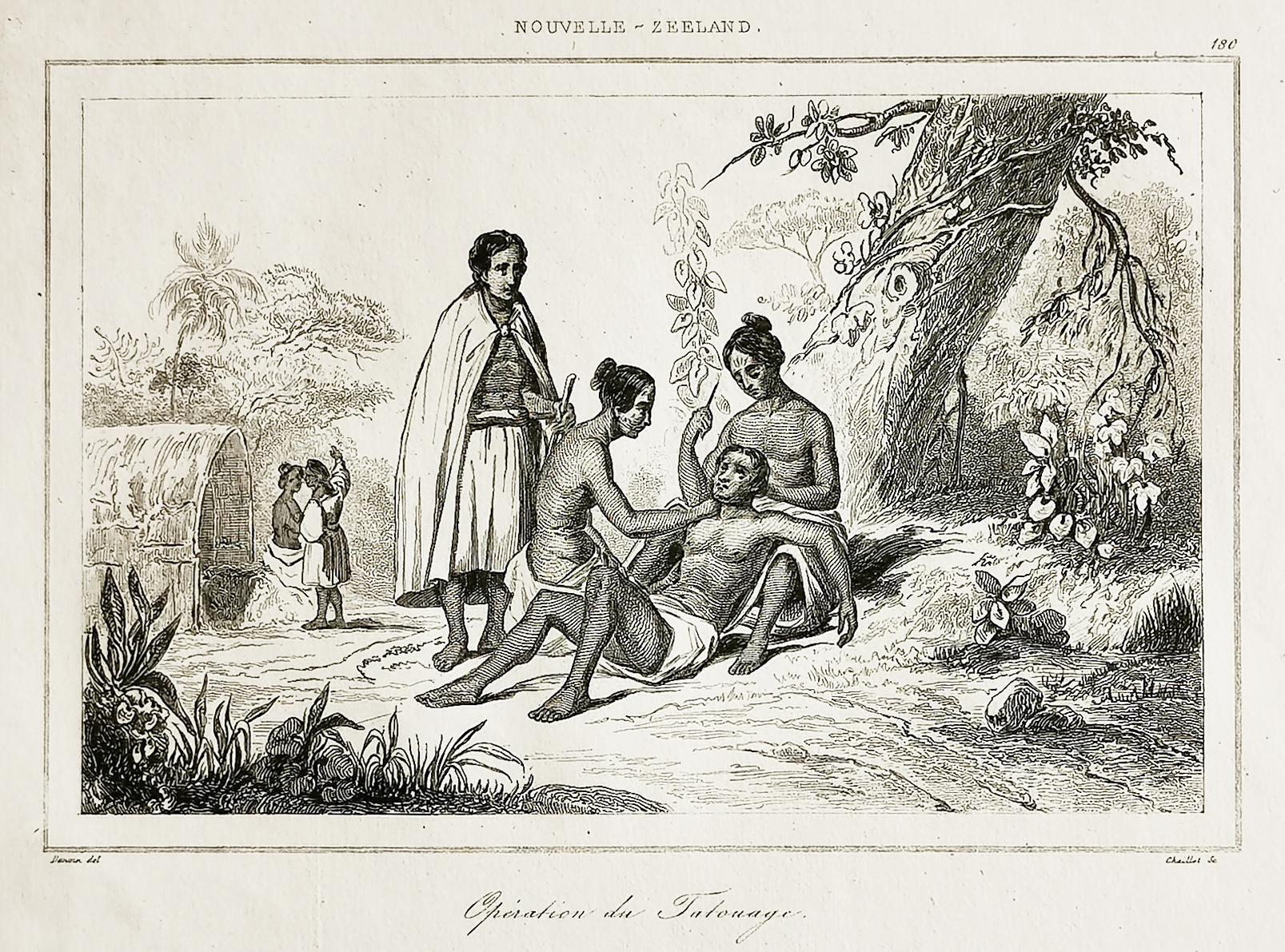 Operation du Tatouage. - Antique Print from 1840