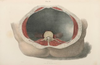 [MUSCLES] Transtubercular Plane Depictin… Anatomical Quain & Wilson