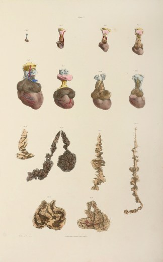 [ORGANS] The Anatomy of the Thymus Gland… Anatomical Quain & Wilson