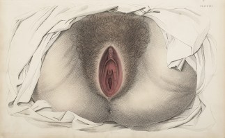 [ORGANS] Urogenital system, female; peri… Anatomical William Home Lizars