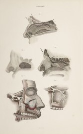 [NERVES] Dissection of the head, nasopharynx, sinuses, trigeminal nerve (cranial nerve V.)