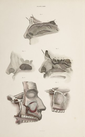 [NERVES] Dissection of the head, nasopha… Anatomical William Home Lizars