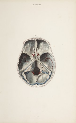 [BRAIN] Dissection of the brain Anatomical William Home Lizars