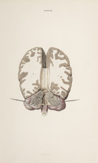 [BRAIN] Brain, cerebellum and spinal cor… Anatomical William Home Lizars