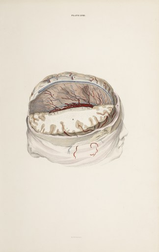 [BRAIN] Dissection of the brain Anatomical William Home Lizars