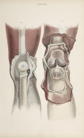 [MUSCLES] Dissection of knee joint