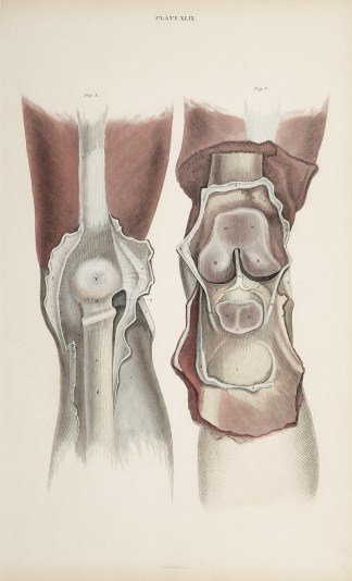 [MUSCLES] Dissection of knee joint Anatomical William Home Lizars