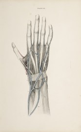 [VASCULAR] Dissection of the hand.