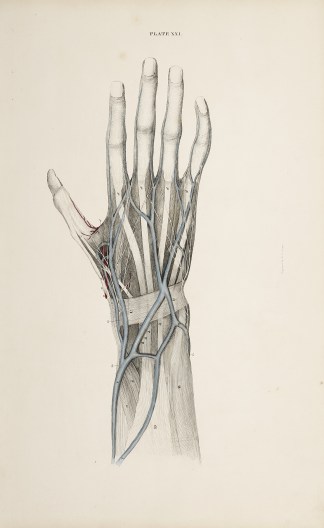 [VASCULAR] Dissection of the hand. Anatomical William Home Lizars