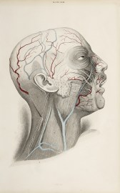 [VASCULAR] Dissection of the head and neck.