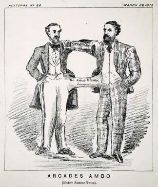 Arcades Ambo (Modern Siamese Twins). - Antique Print from 1873