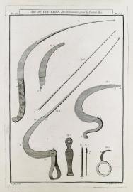 Art du Coutelier, Des Instrumens pour la Fistule &c.