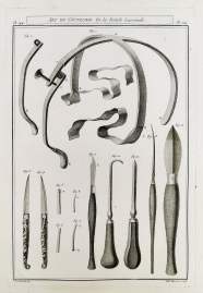 Art du Coutelier, De la Fistule Lacrimale.